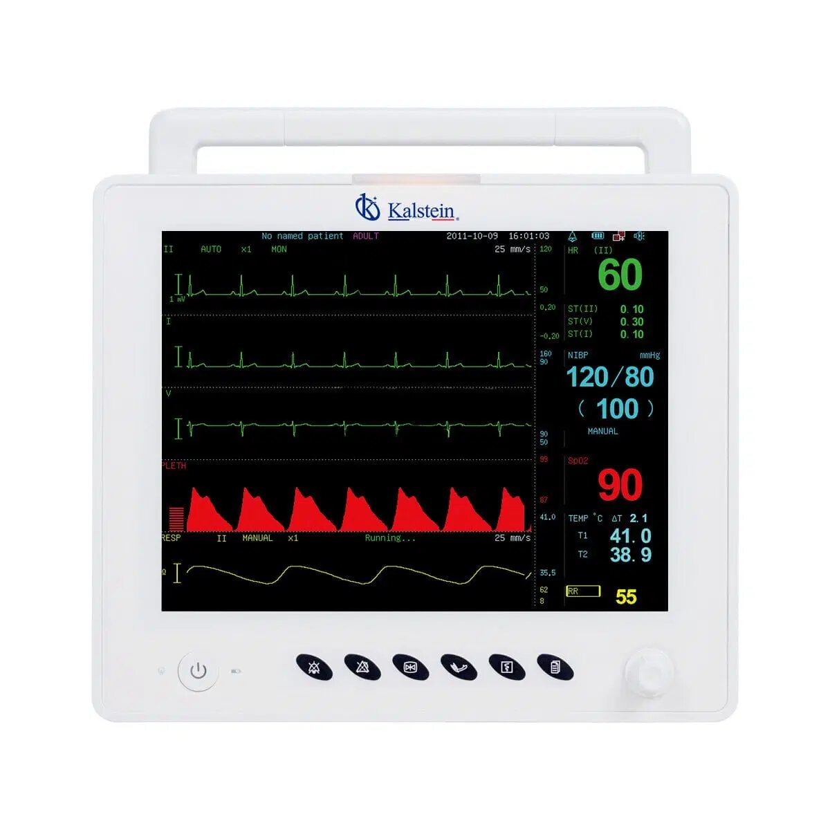An In-Depth Exploration of Veterinary Monitors from Kalstein