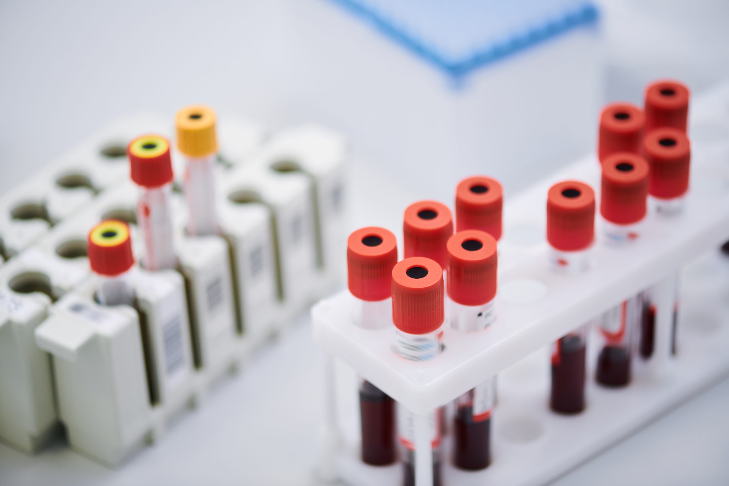 Do you know what the clinical utility of blood tubes is?